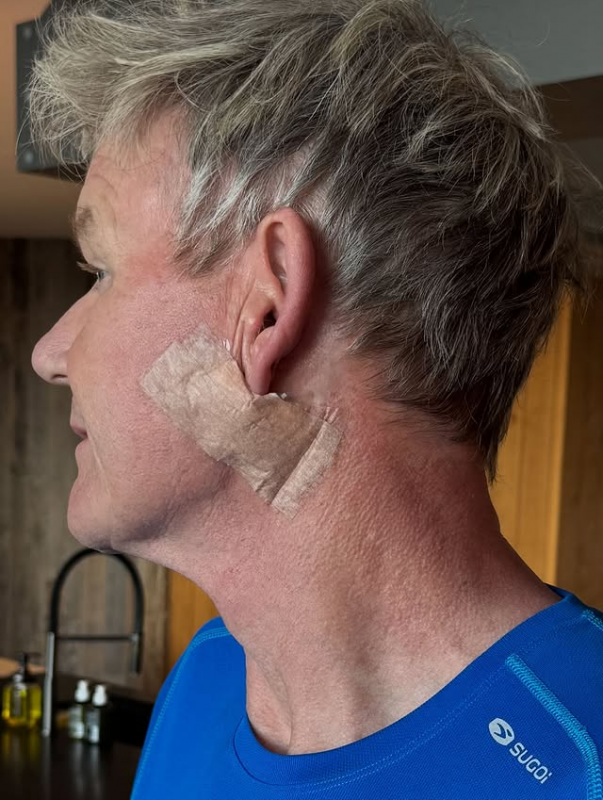 Gordon Ramsay's Urgent Sunscreen
